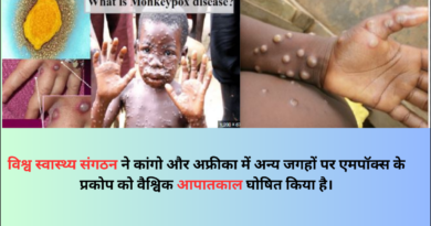 Monkeypox image