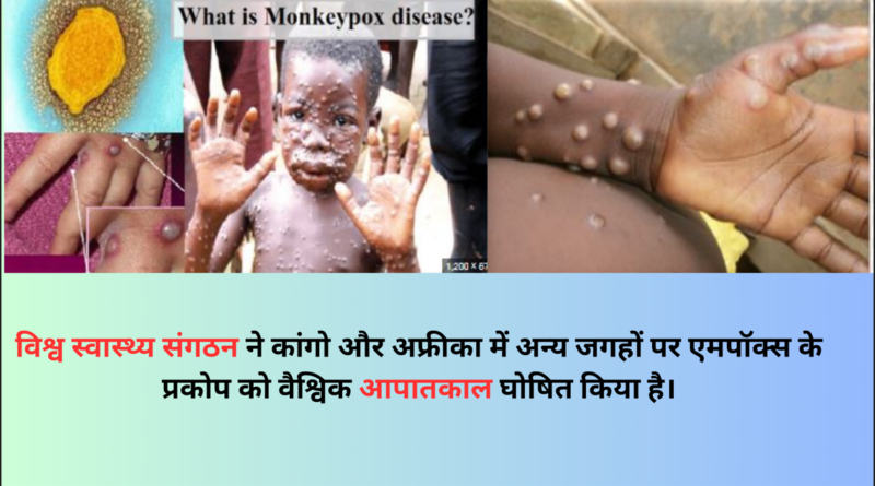 Monkeypox image